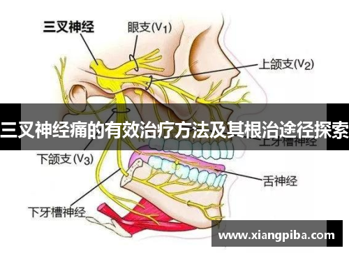 三叉神经痛的有效治疗方法及其根治途径探索
