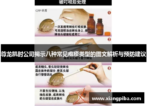 尊龙凯时公司揭示八种常见疱疹类型的图文解析与预防建议